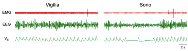 br zoccal fig 3